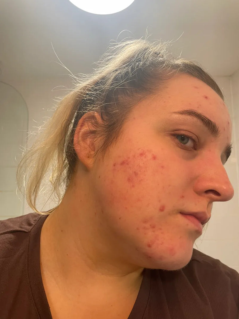 Molly, 27