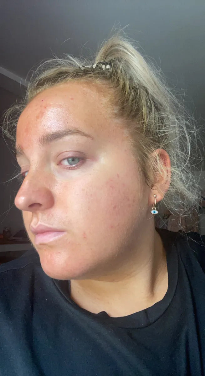 Molly, 27