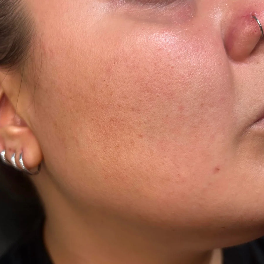 Clear, even skin