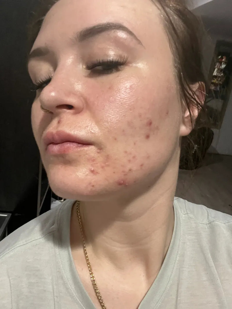 Casandra, 31
