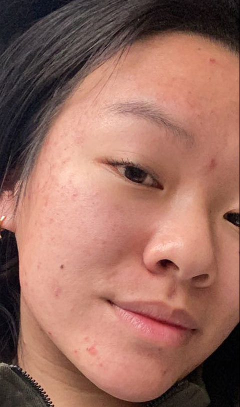 Samia, 24